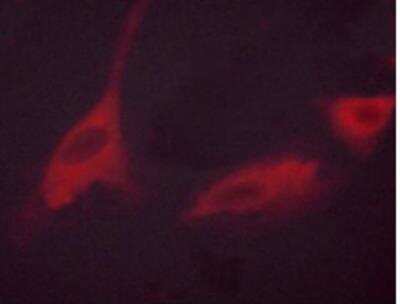 Immunocytochemistry/ Immunofluorescence: p70 S6 Kinase/S6K [p Thr389/412] Antibody [NB600-1049]